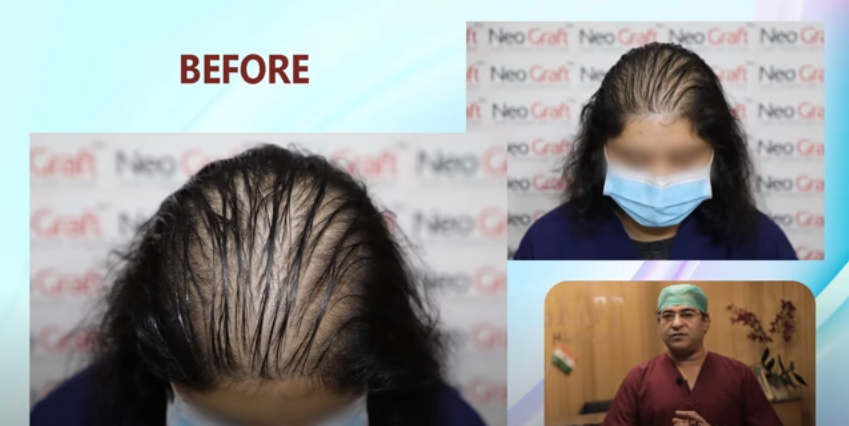 Bondi Boost Anti Hair Loss Support